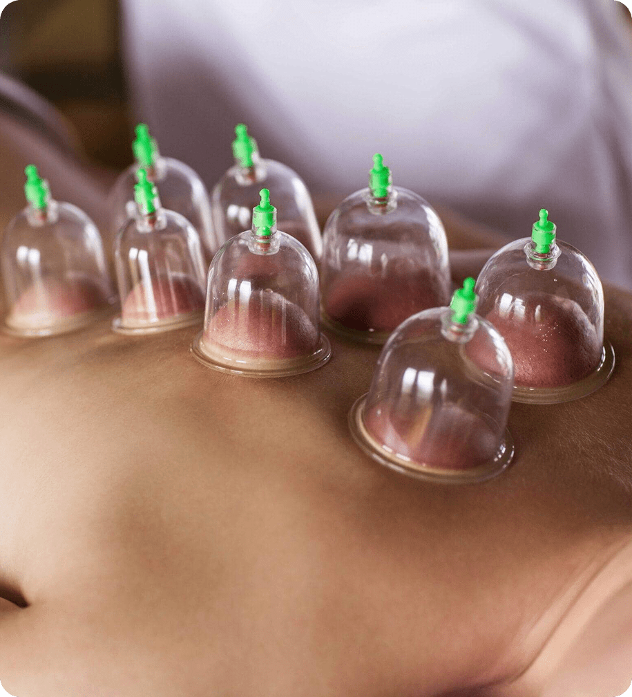 Glass cups for cupping therapy